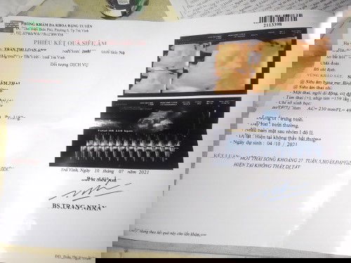 27 tuần 5 ngày em bé được 1187g có nhẹ qá không ạ?