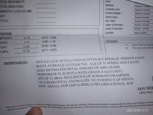 Okay po ba result ng ultrasound ko?