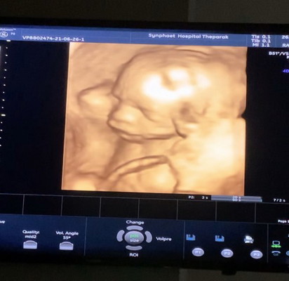 มีความรู้สึกอยากตายไหมค่ะ 😢😔