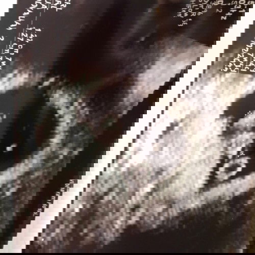 ท้องแรก 7week