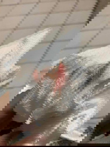 ปวดท้องน้อยหน่วงๆ มีเมือกๆสีชมพู