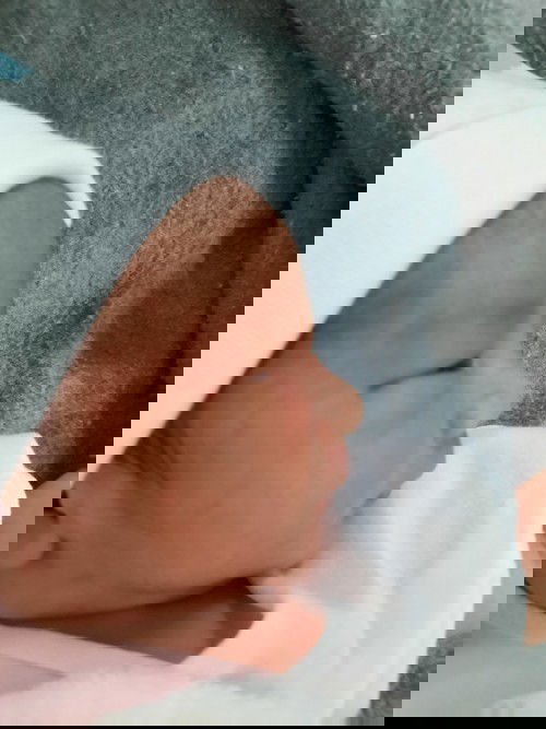 แชร์ประสบการณ์การผ่าคลอดของคุณแม่ที่มีโรคประจำตัวจ้า #ทีมกรกฎา แอบแตกก่อนไม่รอล่ะนะ