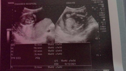 เเม่ๆท่านไหนมีประสบการณ์บ้างค่ะ