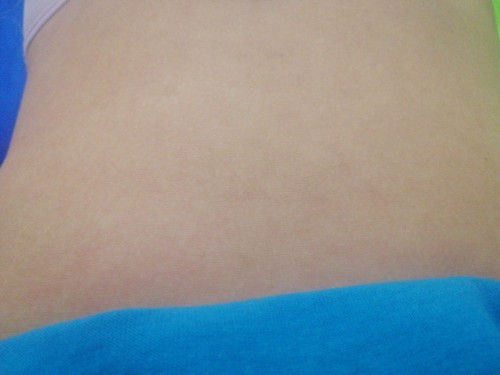 natural lang po ba, na kumakati ang tyan kapag 6 weeks palang po, kasi ung tyan ko namumula n makati