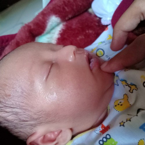 Cara ngilangin putih2 dimulut bayi?