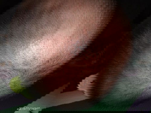 Kerak pada kepala bayi