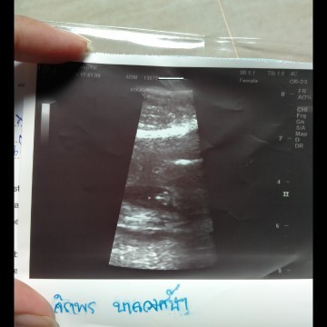 ลูกคนแรกค่ะ