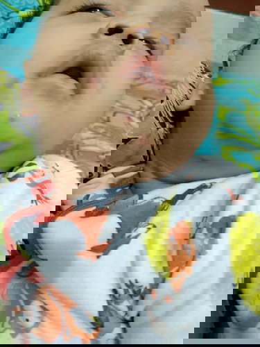 Apakah ini termasuk alergi ya??? Klo iya alergi apa?