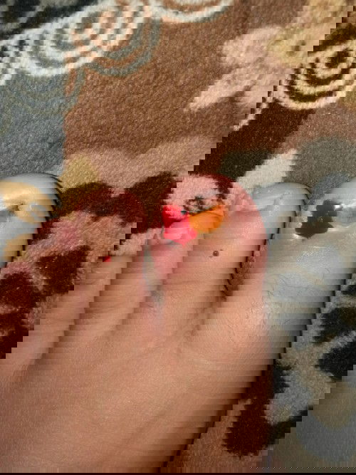 Saat hamil jempol kaki berdarah dan bengkak