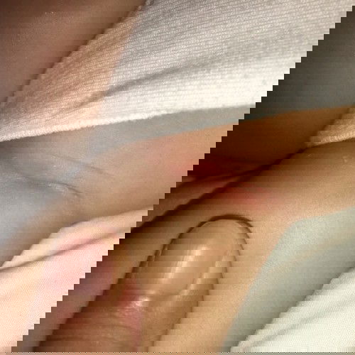 Pamumula sa kili kili