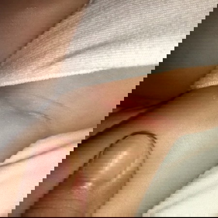 Pamumula sa kili kili