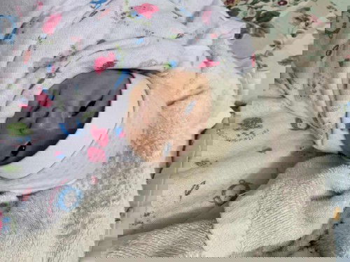 จุดแดง ผื่นบนใบหน้าลูก