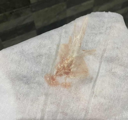 Progesterone discharge???