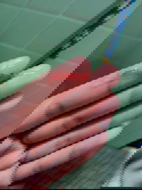 กระตุ้น