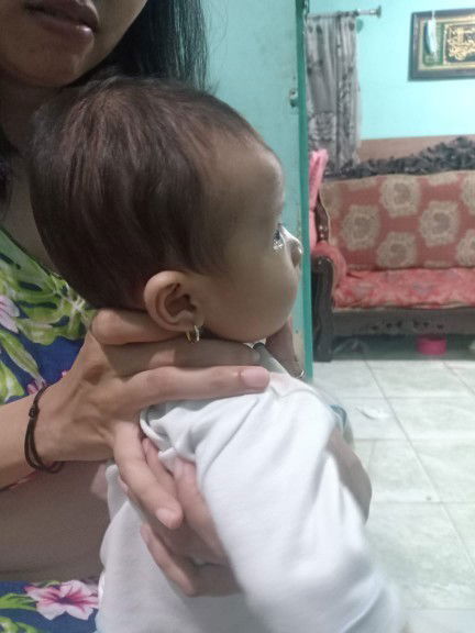 Kepala lonjong/ peyang