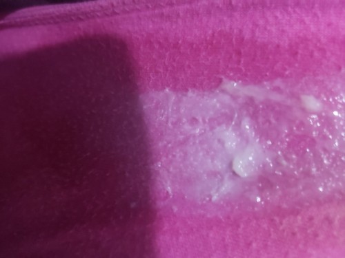 normal lang po ba ito