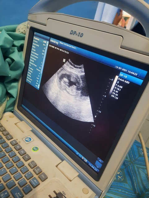 Ada yang pernah ngalamin gini ga bunda bunda ?