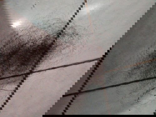 NEED HELP..RAMBUT RONTOK PARAH