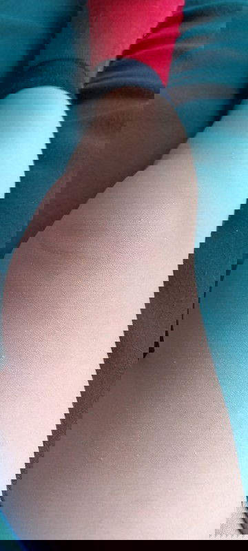 Bintik2 di paha dan betis