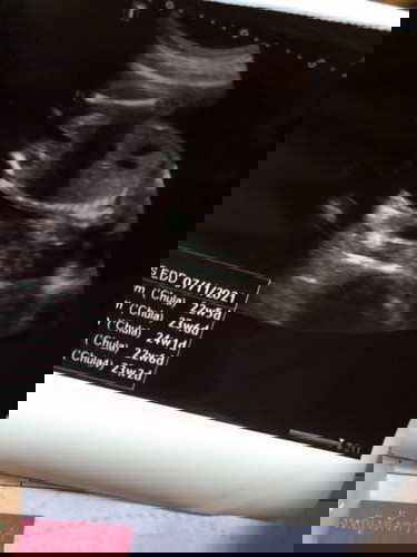 สามารถดูได้มั้ยค่ะ ว่าญรึช