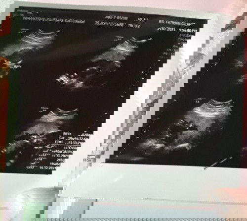 Usia kandungan 19 minggu