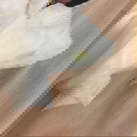 Yellow discharge