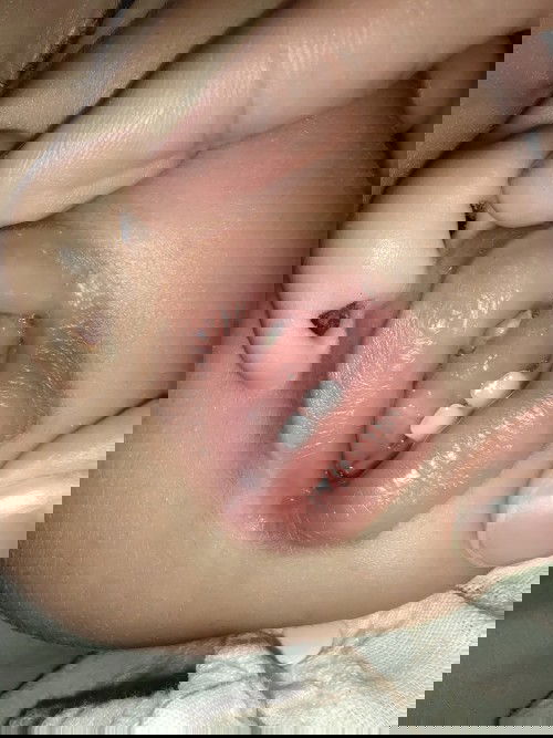 ฟันเหลืองได้ไง?