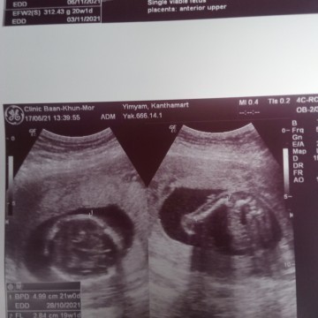 ดูไม่ออกเลยจ้า