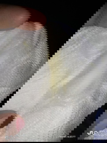 สอบถามแม่ๆค่ะ กำหนด17กรกฎา64 วันนี้มีอาการคล้ายปวดประจำเดือนตั้งแต่เช้า จนตอนนี้เวลา 21:47 ยังไม่หาย