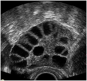 มีบุตรยากมาทางนี้