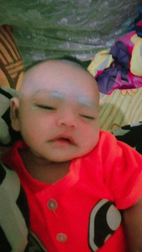 Bun,bayi saya nafasnya nggrok-nggrok gmna ya cara mengatasi nya?