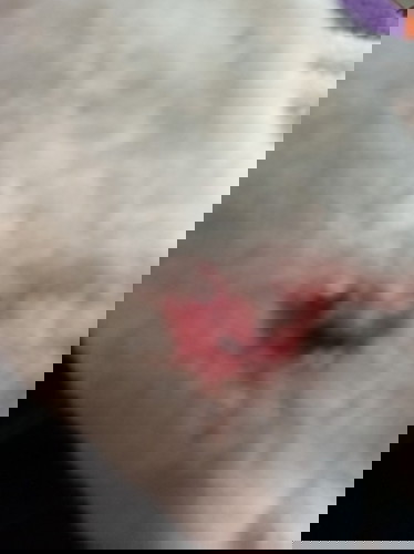 Sino na po dto nagpa I.E na nakaranas po ng dinugo??