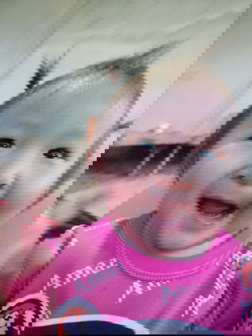 1ปีเต็มฟันยังไม่ขึ้น🥲