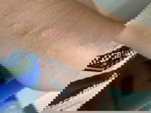 22วีค4วัน ท้องที่2