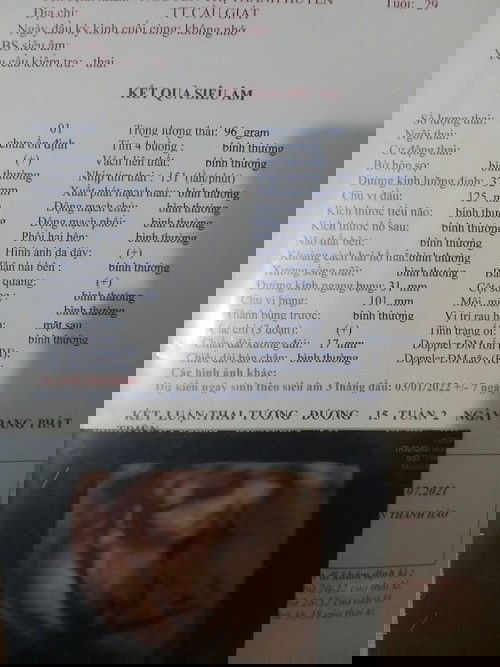 #chu vi đầu #15w2d