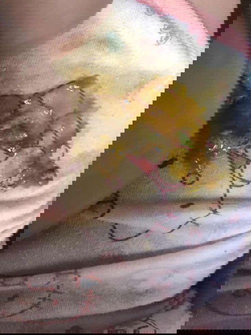 น้องอึสีแปลกไหม สีออกเขียวเหลืองมีมูกใสๆ