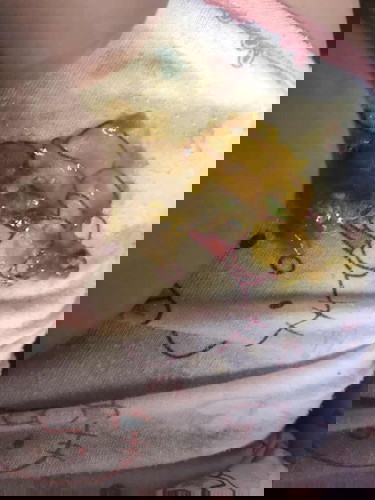 น้องอึสีแปลกไหม สีออกเขียวเหลืองมีมูกใสๆ