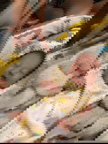 วันนี้น้อง 17วัน ลานนมแม่สั้น น้องกินจากเต้ายากมาก เลยต้องกินนมเสริมเพิ่ม ขอสอบถามหน่อยค่ะ