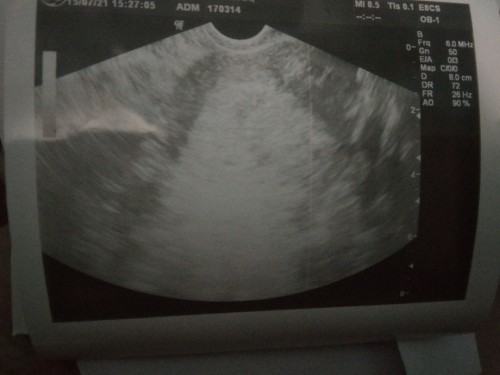 Mau tanya hamil 4 week