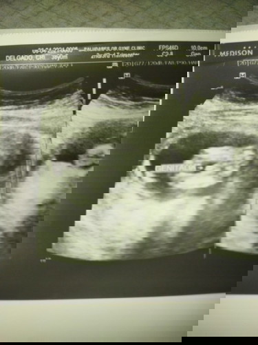 Pa help po ano po gender ng lo ko?