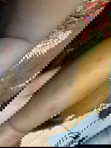 BINTIK MERAH PADA KAKI BAYI