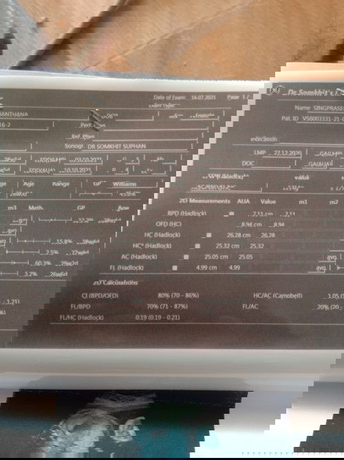 แม่ๆๆว่าน้ำหนักน้องน้อยไปไม้คะ