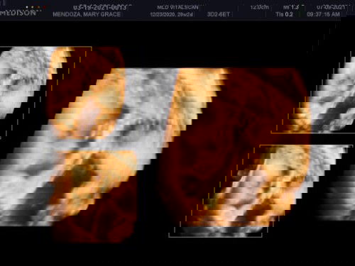 team September here 🤗🤗
2months to go ❣️❣️ ayeee !!