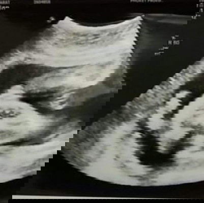 มาดูกันให้หน่อยนะคะ ช/ญ 😊