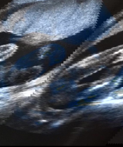 ทีมพย 23+4w