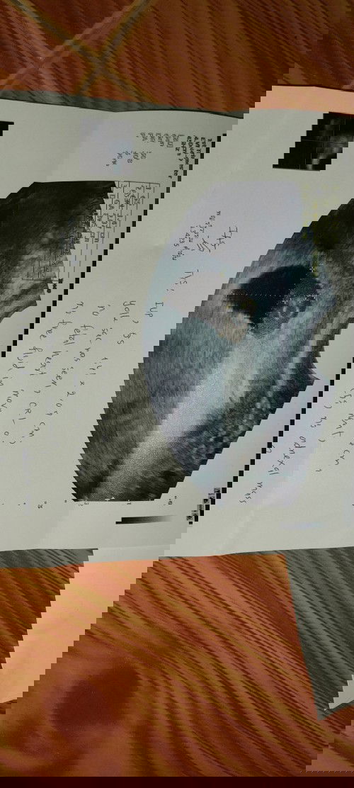 ท้องได้8สัปดาห์ อัลตร้าซาวด์ทางช่องคลอดแล้ว หมอบอกไม่มีการเต้นของหัวใจ