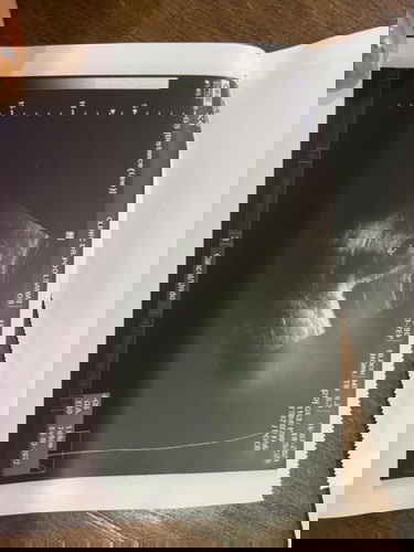 แม่ๆซาวกี่ครั้ง เห็นตัวเด็ก ตอนกี่w