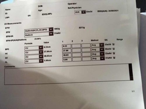 ขอสอบถามแม่ๆหน่อยค่ะ