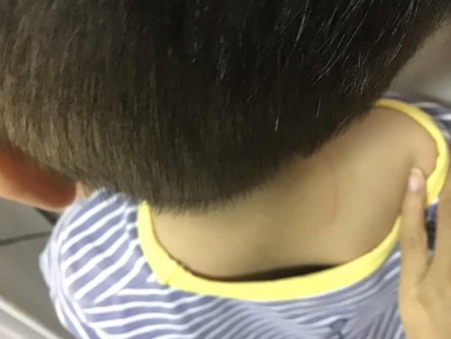 ลูกตกลงมาเอาหัวลงก่อน ทำไงดีคะ?