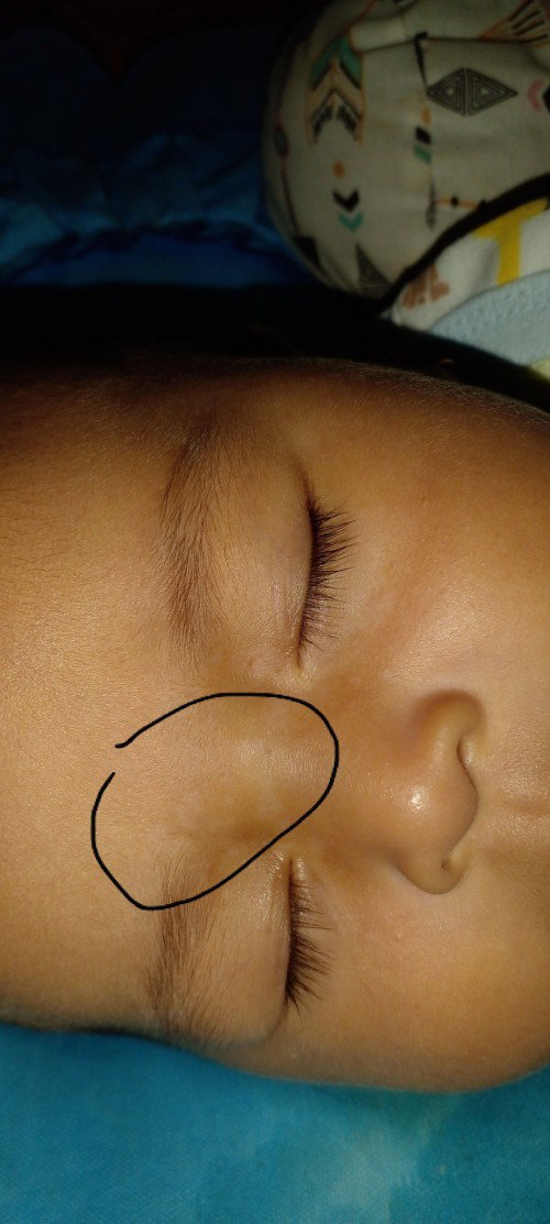 Bercak putih di dahi